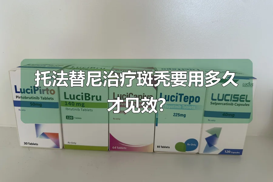 托法替尼治疗斑秃要用多久才见效?